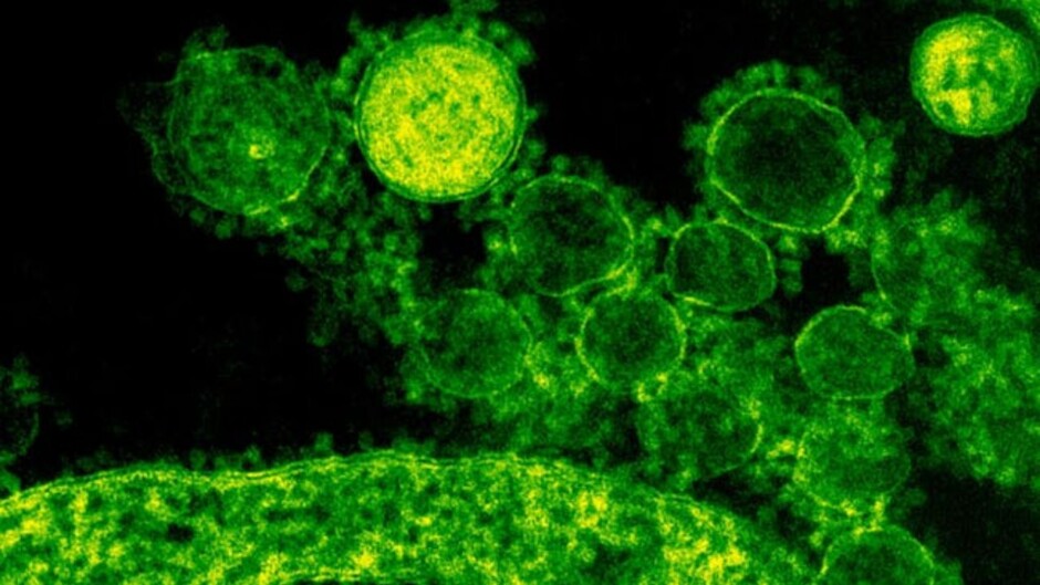 flesh-eating bacteria